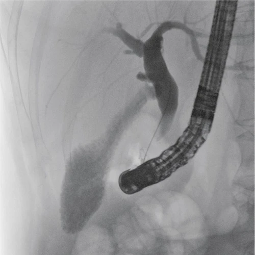 cathlab